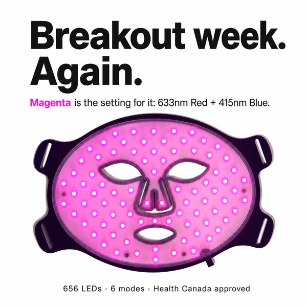 Breakout mode, built in.