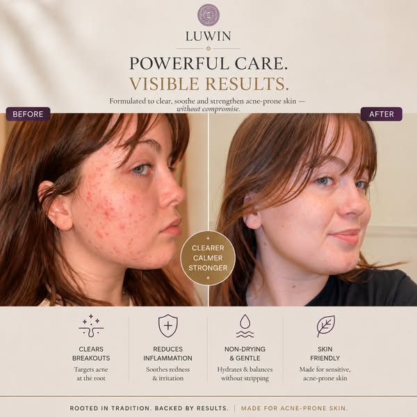 Calm Skin Without Burning Or Stripping