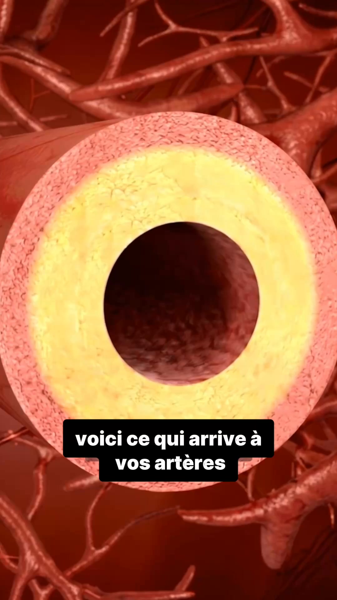 1 Acheté, 1 Offert