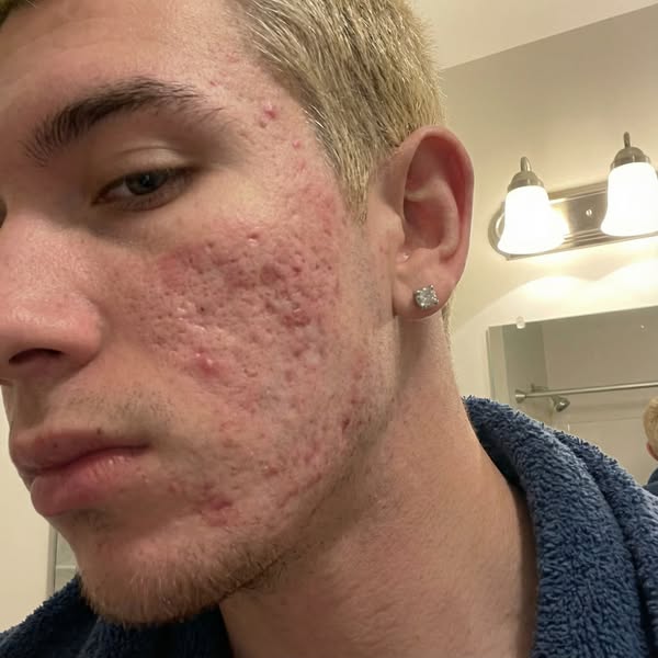 Why Scar Treatment Fails