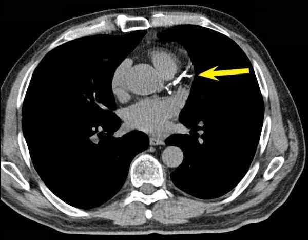 ED and enlarged prostate?