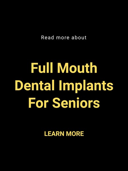 Full Mouth Dental Implants for Seniors: What to Know