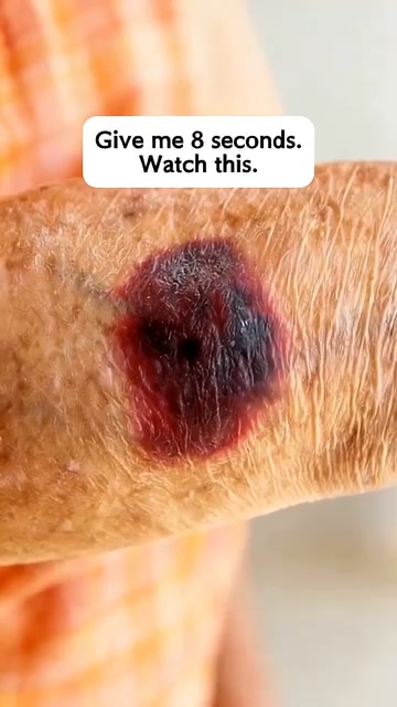 Anúncio de Dr. Surface