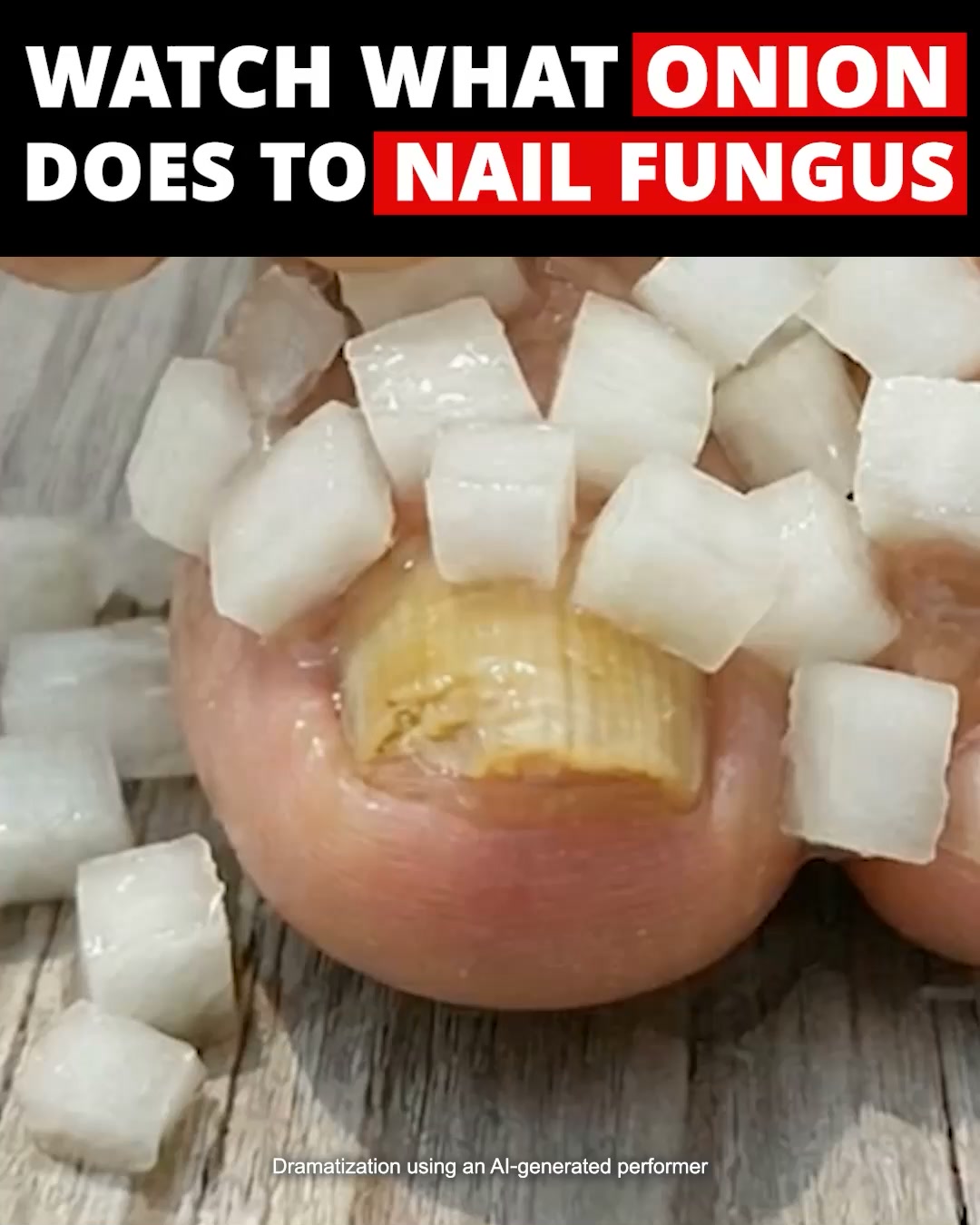 Fastest Way To Clear Yellow Toenails