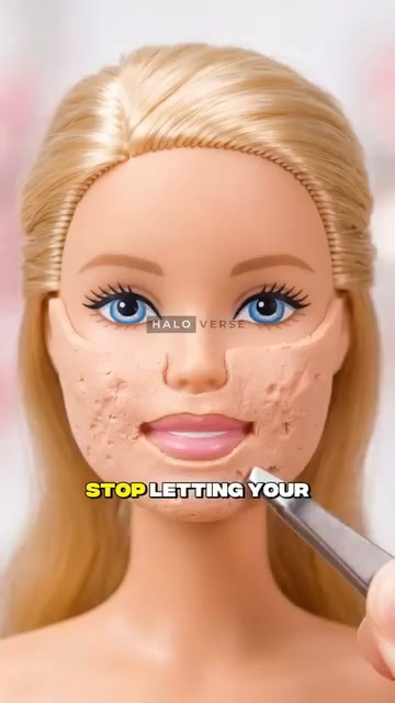 My Acne Scars Look Less Visible