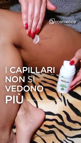Trattamento specifico per vene e capillari. Provalo!