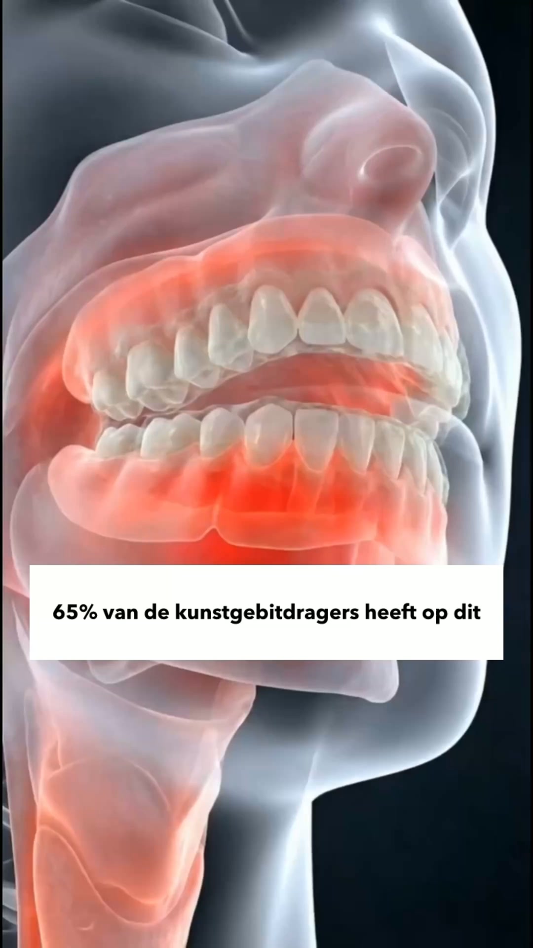 De nr. 1 door tandartsen aanbevolen kunstgebitreiniger