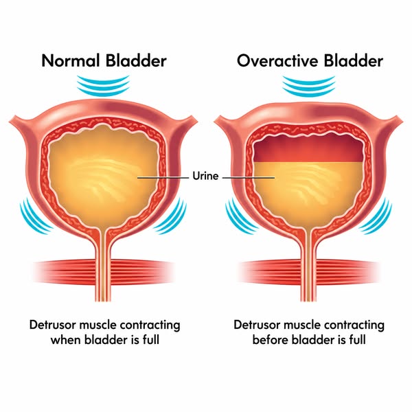 Reduce bladder leaks — naturally