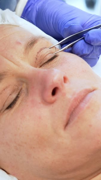 Say goodbye to drooping eyelids. Naturally