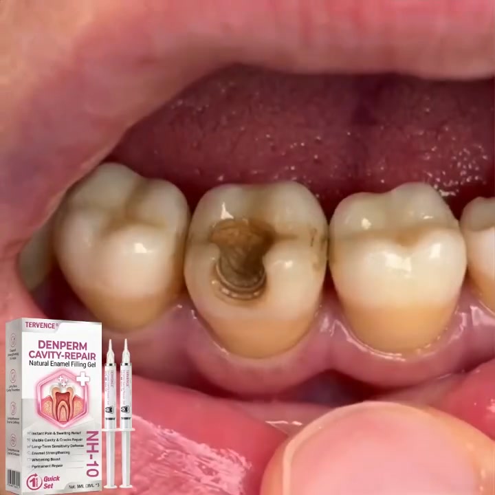 Cavity Repair FDA-Recognized 10% Nano Hydroxyapatite (NH-10) | Delivery within 2-4 working days...