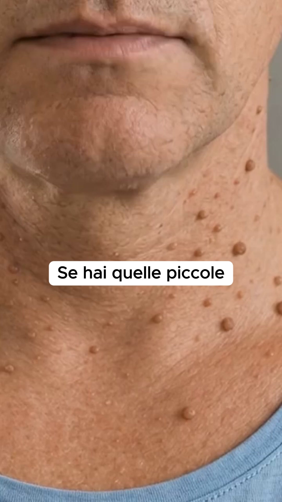 Ho fatto TUTTO per perdere peso. Tutto tranne questo.