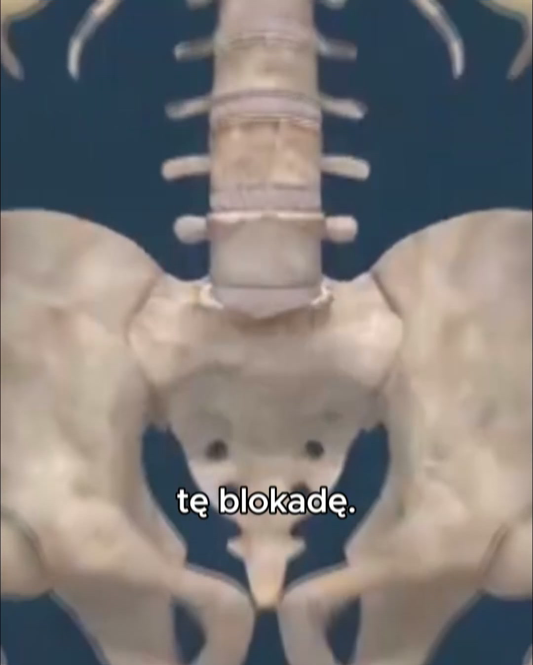 Ból pleców lub rwa kulszowa?