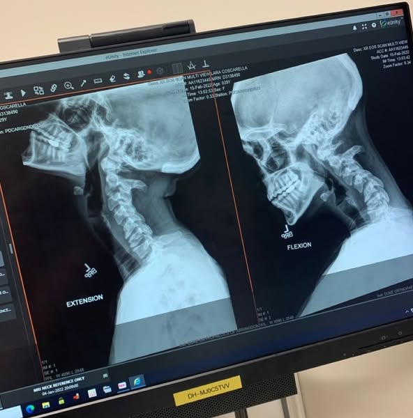 VERTIGO ISN’T JUST DIZZINESS