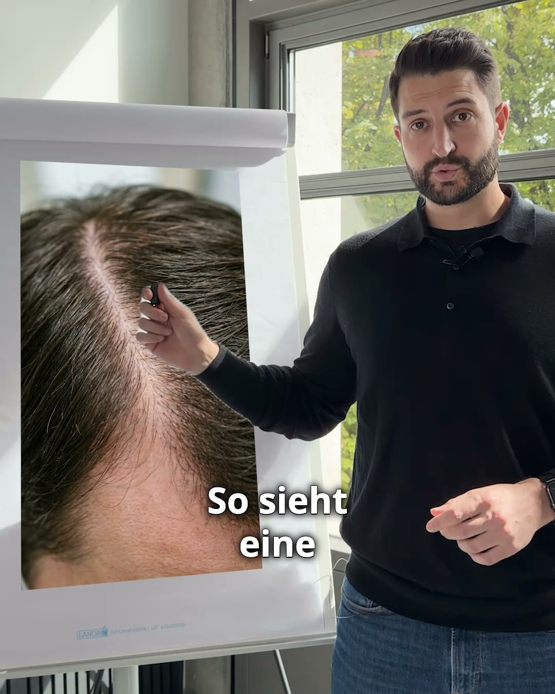 Juckende Kopfhaut nervt? Mach Schluss damit.