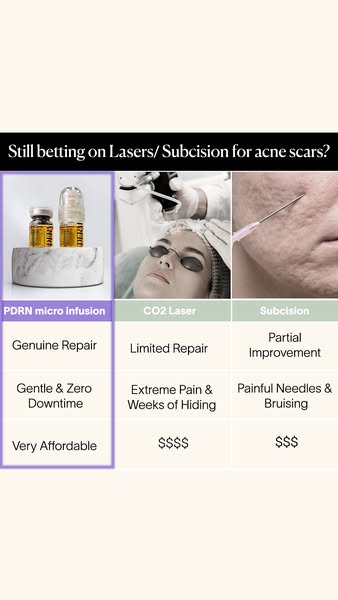 Fade Post-Acne Scars at Home