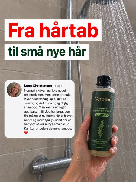 Farvel hårtab — goddag nyt hår