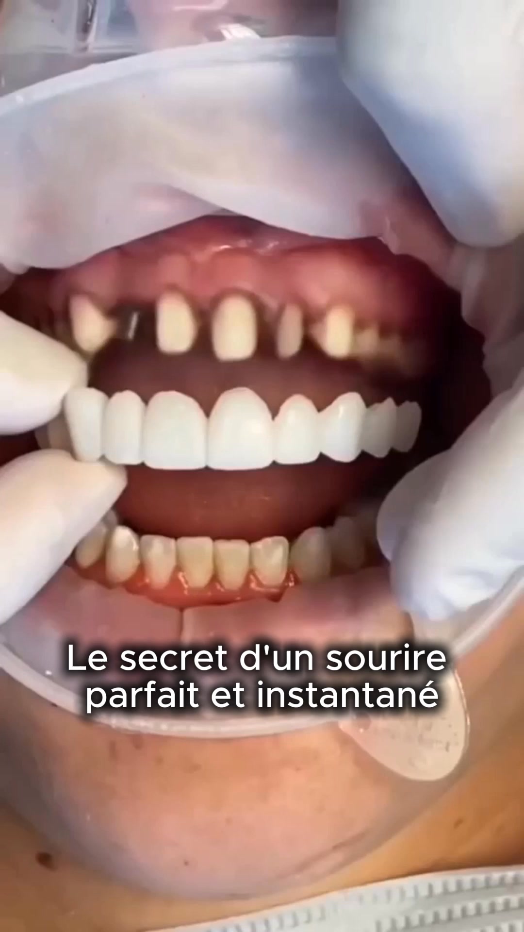 Et si le problème n’était pas vous… mais votre sourire ?