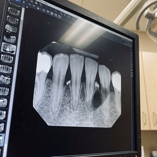 She flossed every day... her teeth came out anyway