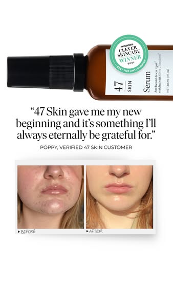 A skin treatment that actually works