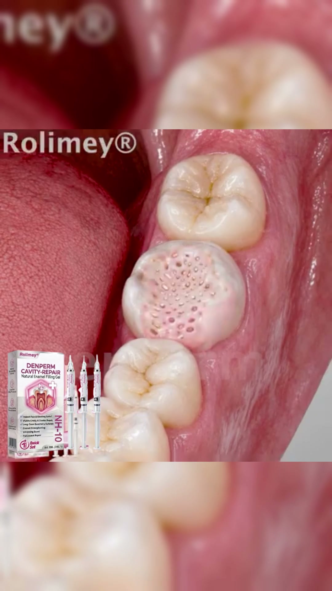 Cavity Repair FDA-Recognized 10% Nano-Hydroxyapatite (NH-10) | Delivery within 2-4 working days | Full refund guarantee
