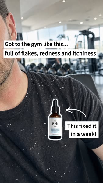 Still Flaking? This Was Made for You.
