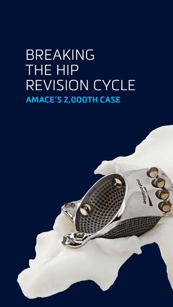 The Story Behind aMace's 2,000th Case