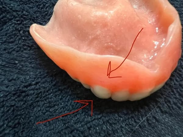 Read this if you wear dentures and use cream.