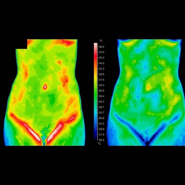 If prolapse repair is already on your calendar, read this