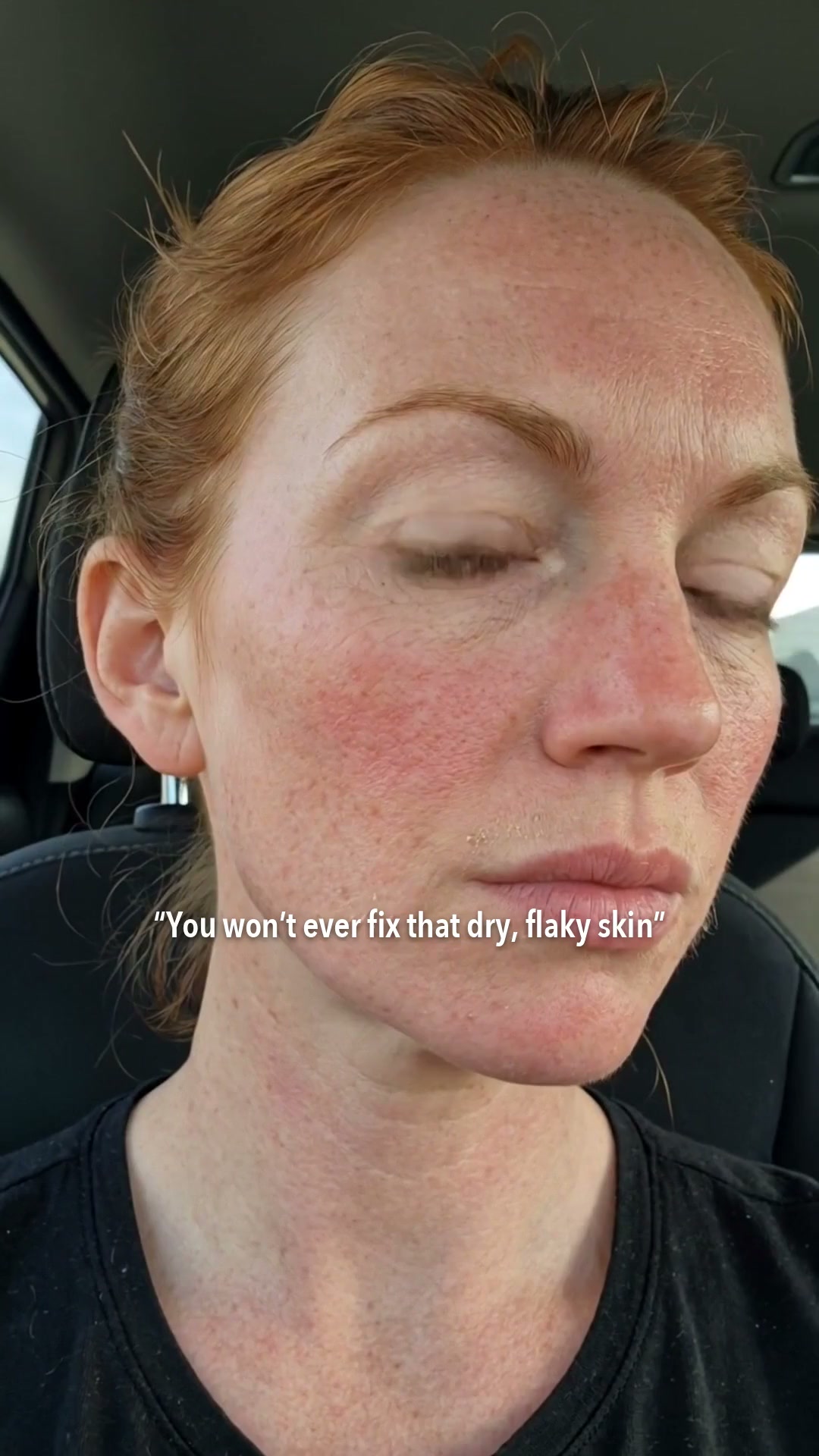 [Amazon's Pick] Hyaluronic Acid Hydrating & Plump Glow Serum