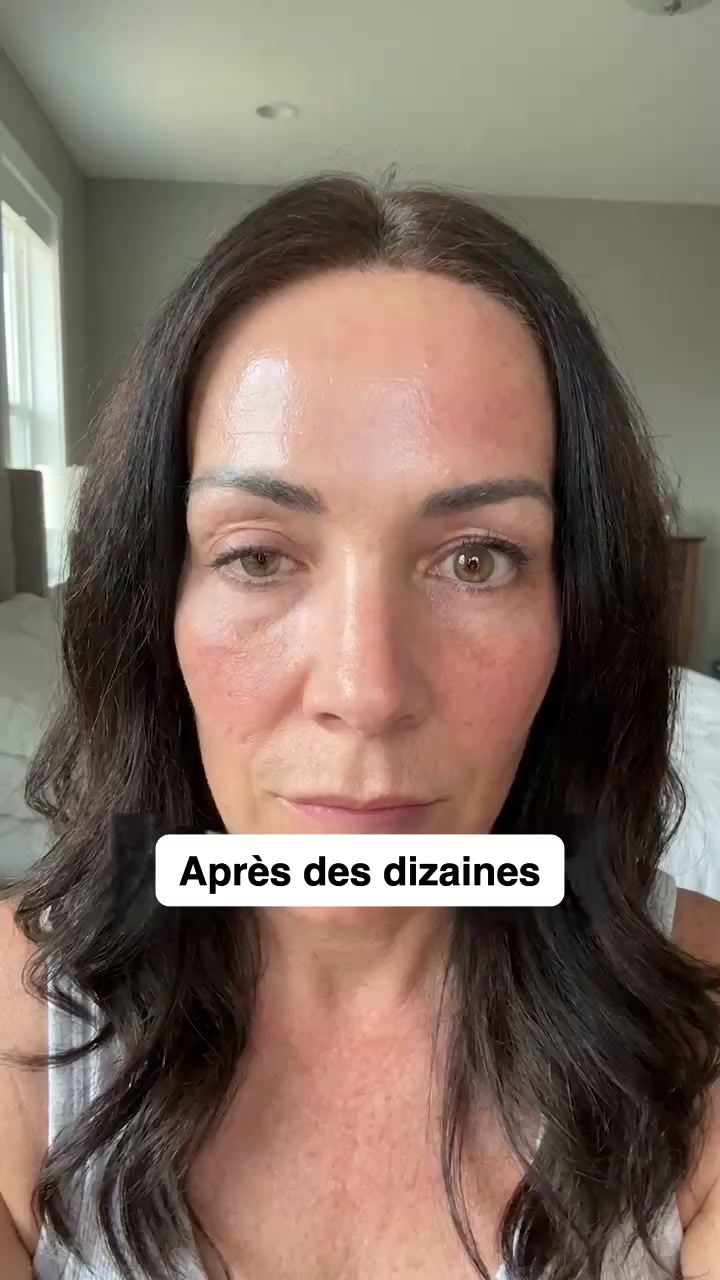 Retrouve une peau plus lisse et lumineuse