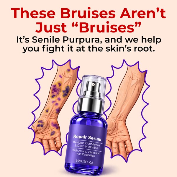 The #1 Most Trusted Serum For Paper Thin Skin