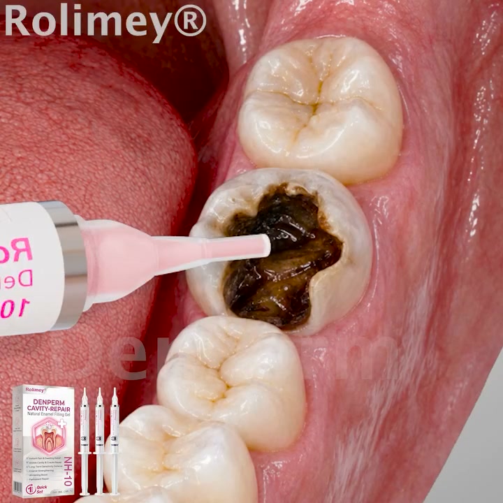 Cavity Repair FDA-Recognized 10% Nano-Hydroxyapatite (NH-10) | Delivery within 2-4 working days | Full refund guarantee