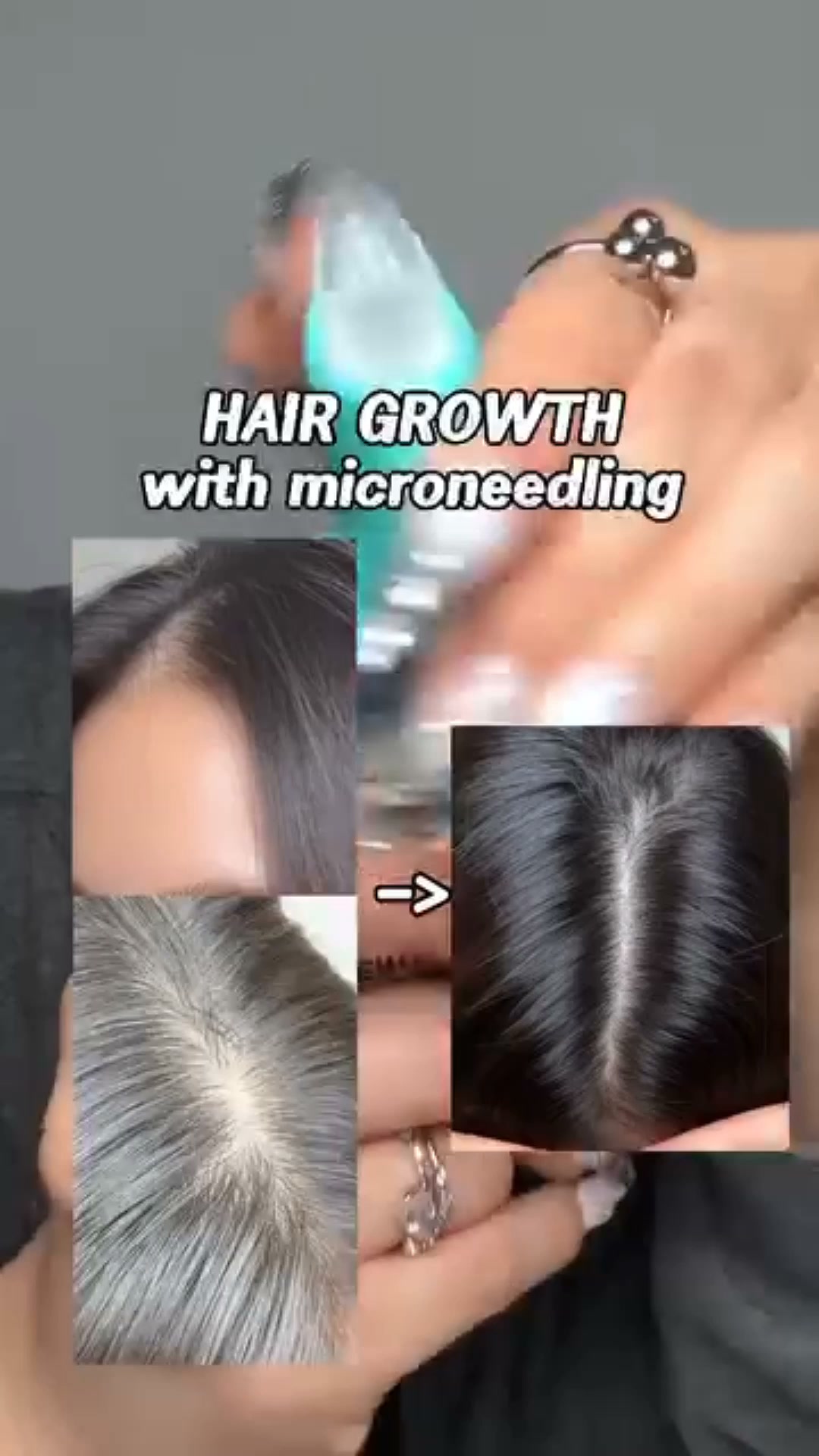 The Scalp Serum With a Built-In Brush