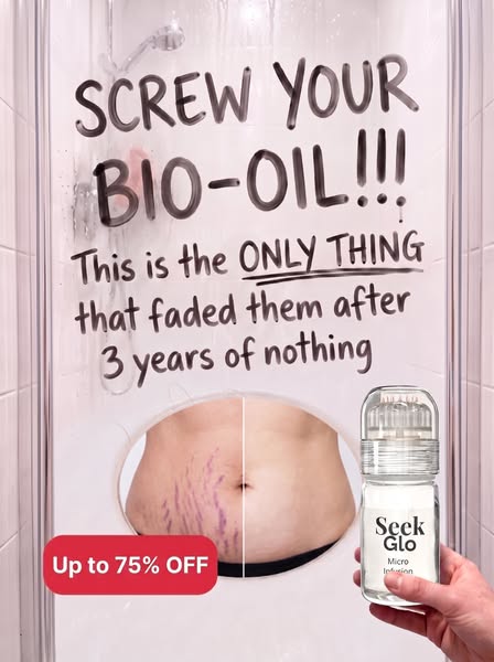 Stretch Marks? Try This At Home