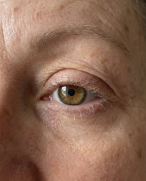 Lashes back. No prostaglandins.