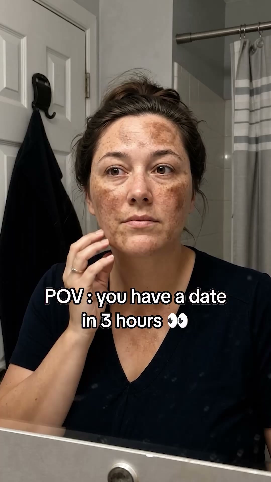The Cream She Used on Her Dark Spots
