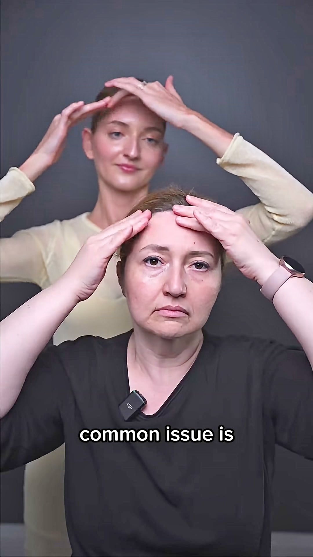 Hooded eyes, Smile lines, Jowls, Eye bags, Double chin