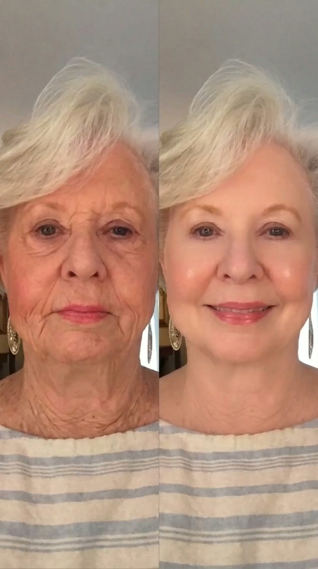 Korean Face Lift in a Serum