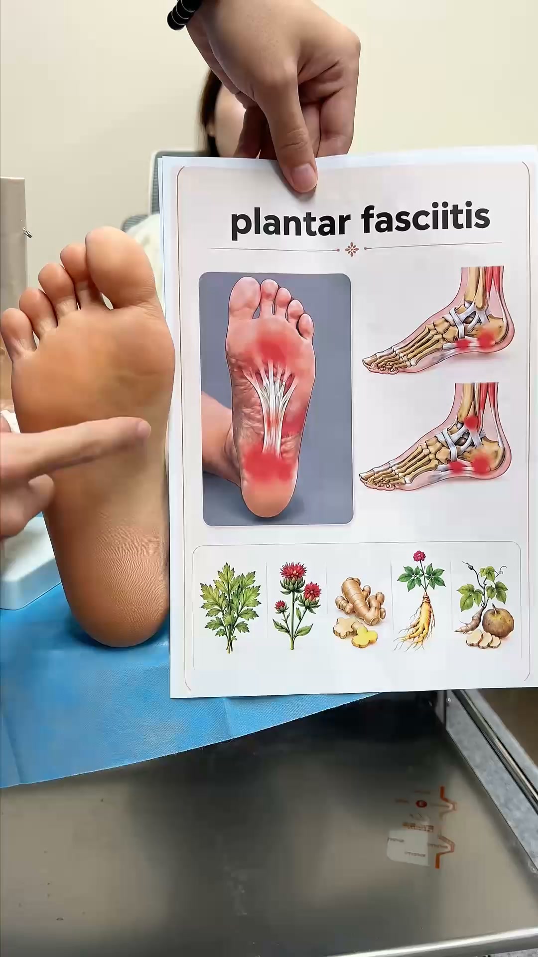 3 Years Of Plantar Fasciitis
