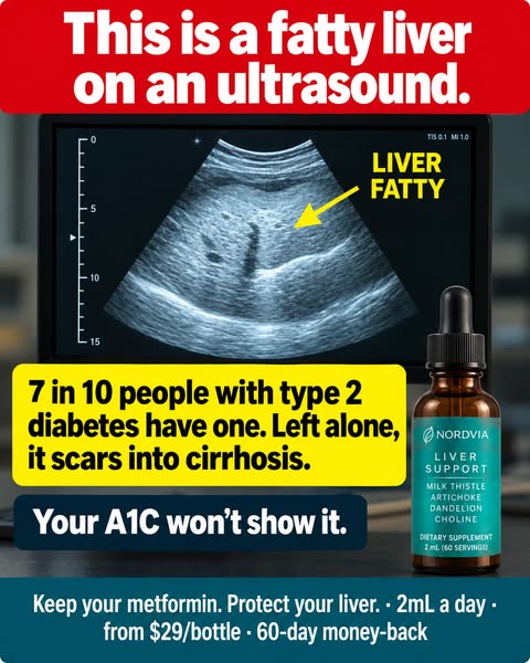 This is a fatty liver on an ultrasound