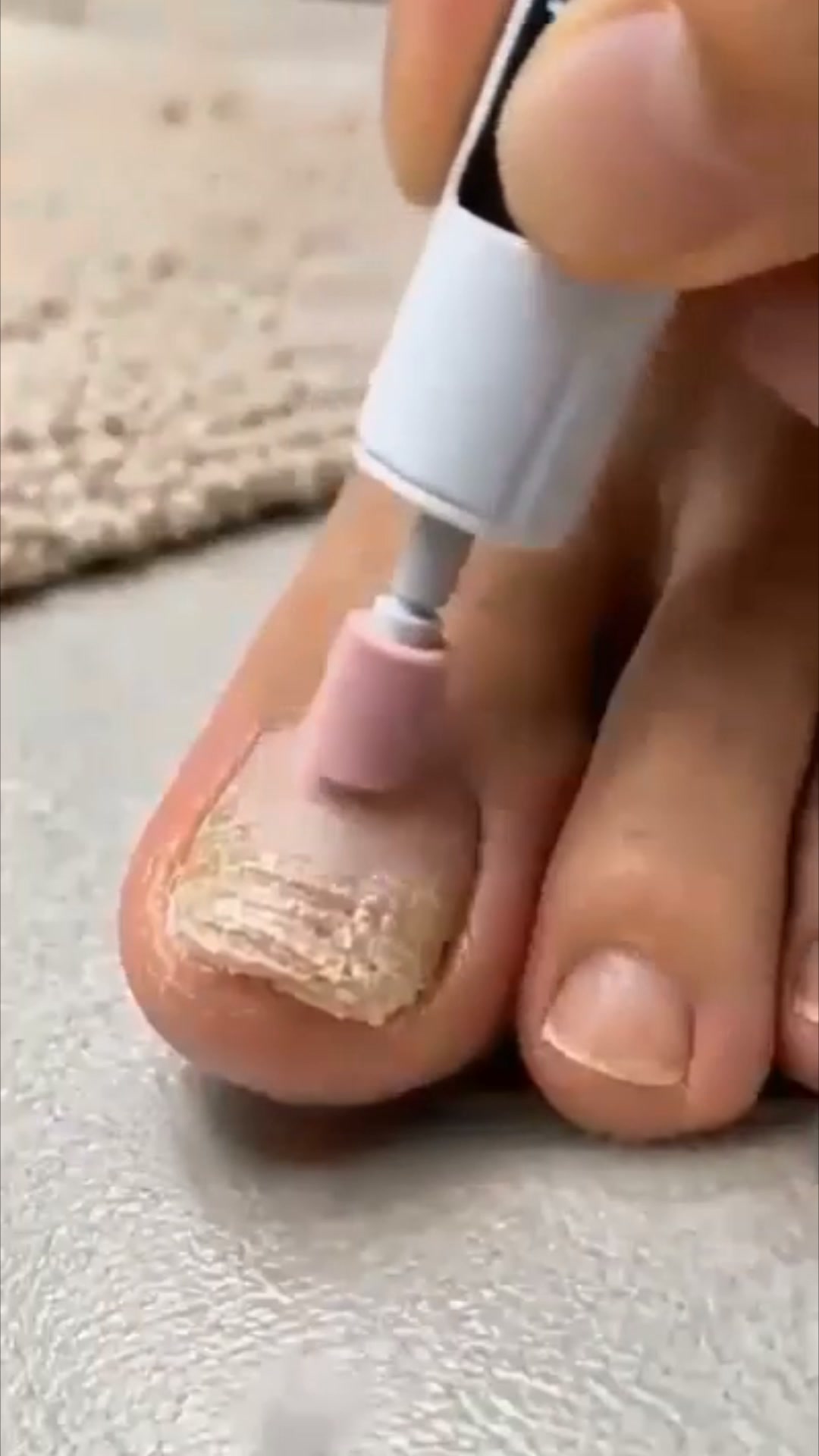 #1 Präzise Nagelpflege