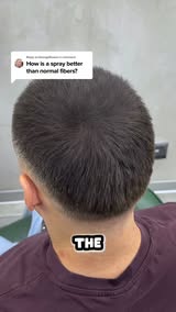 Seeing More Scalp Lately?