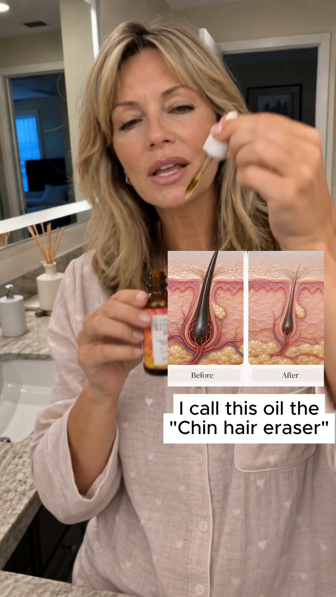 Still Dealing With Stubborn Chin Hair?