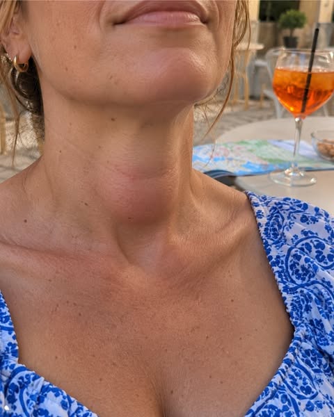 Hashimotos? Ignorera inte detta