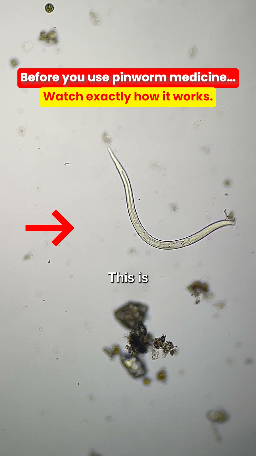 1 in 3 Kids Have Parasites. Most Moms Never Know.