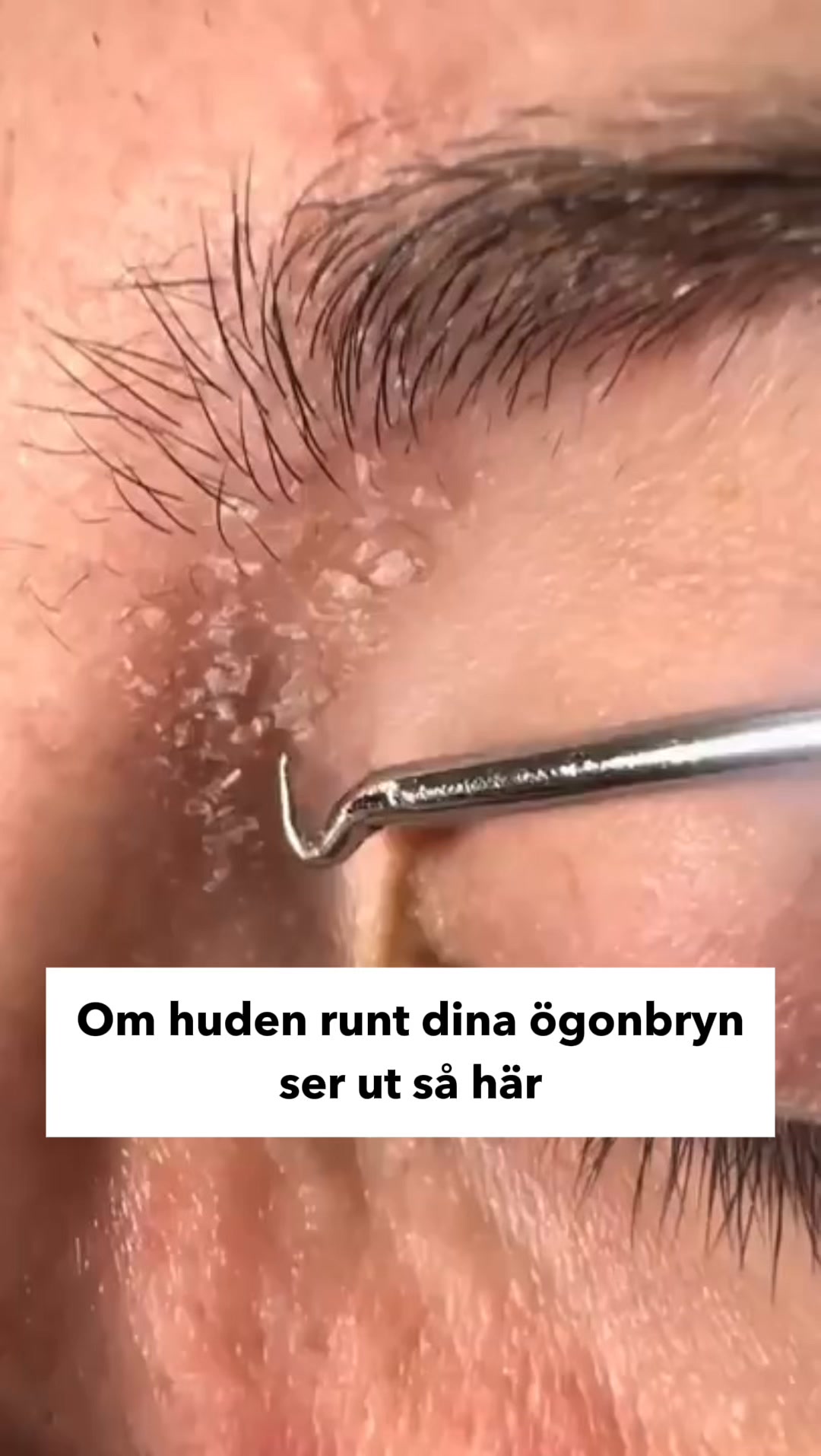 Återställ Hudens Balans, Naturligt