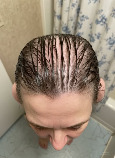 If my TSH is "normal"... then why is this happening?