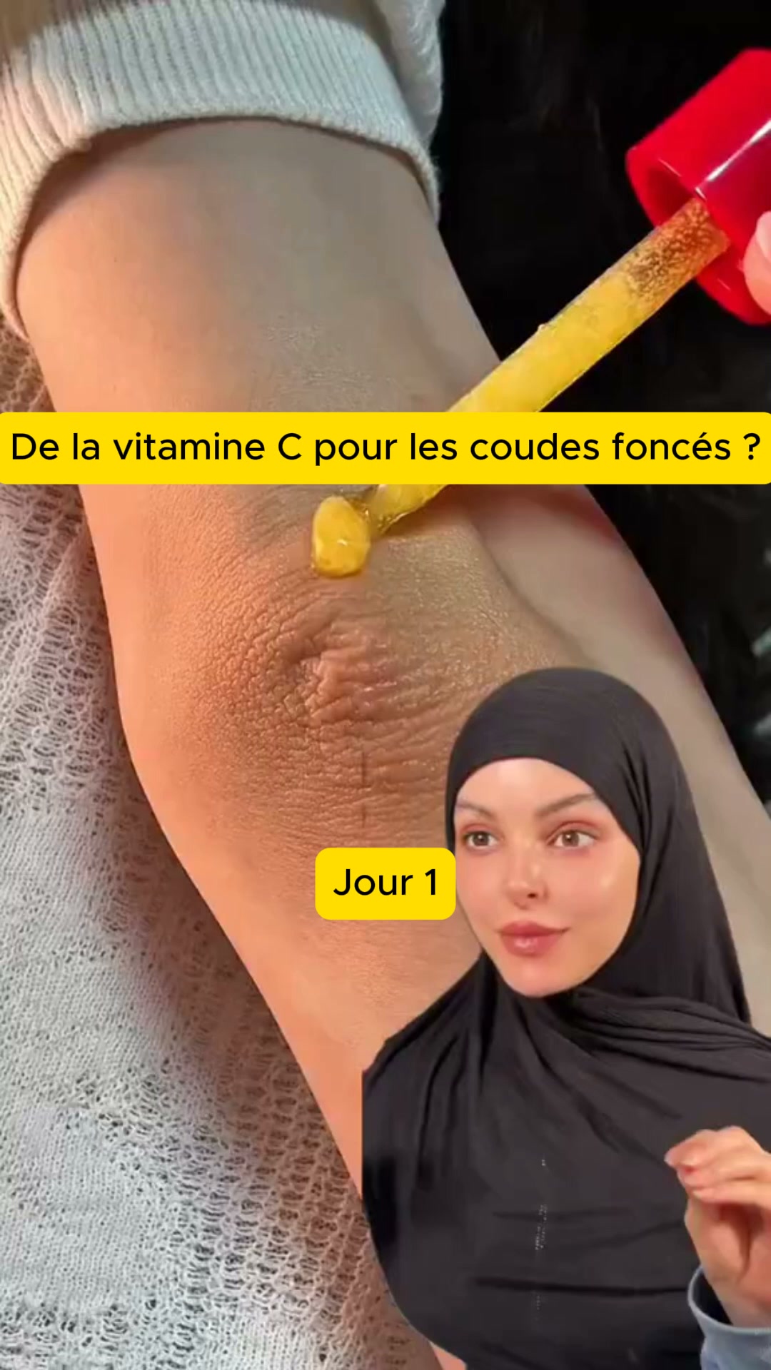 Taches atténuées en 7 jours