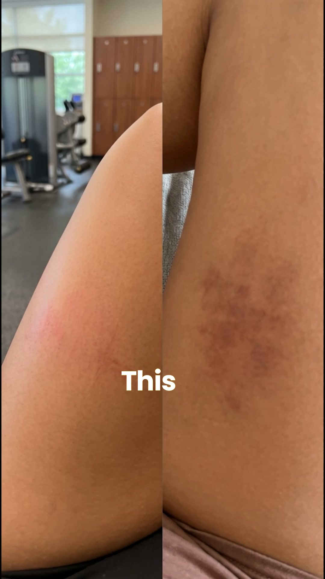 8 hours in leggings and your skin is paying for it