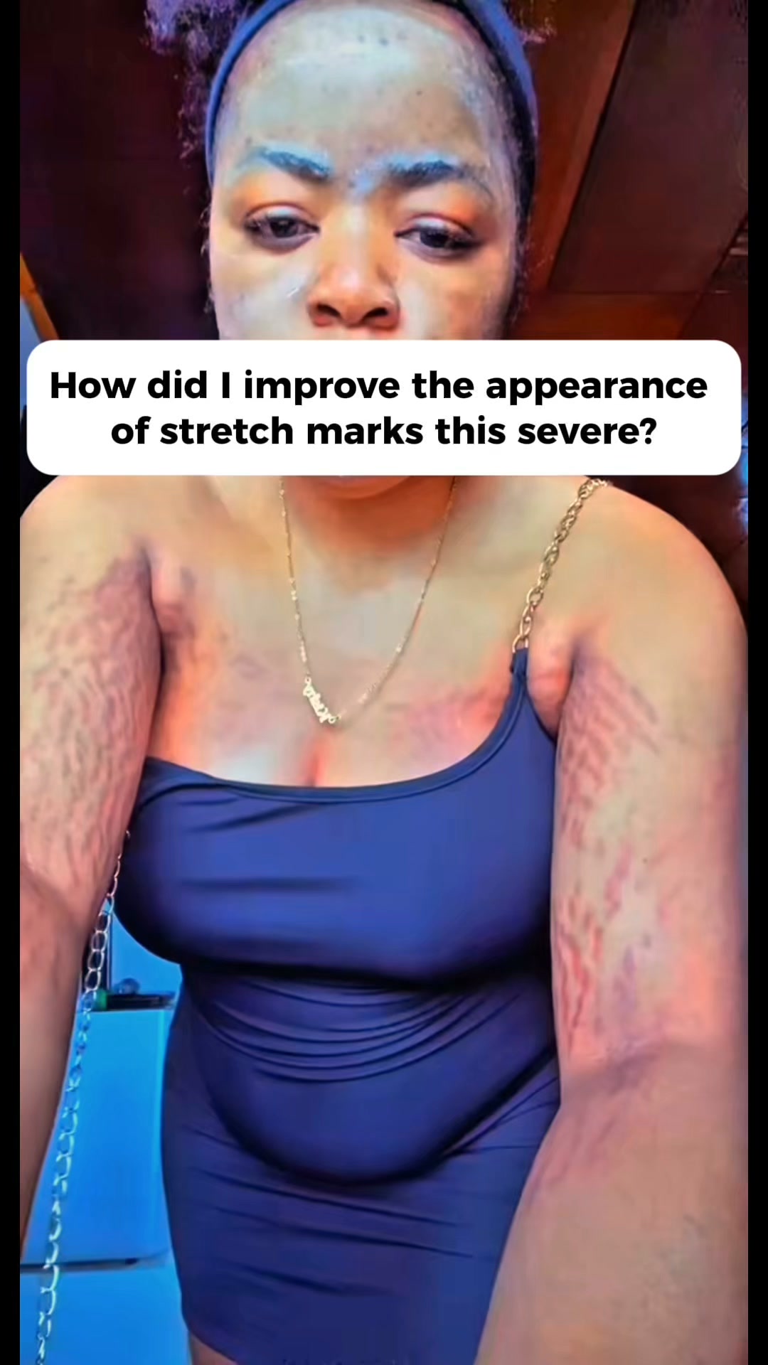 Target Rough-Looking Elbows